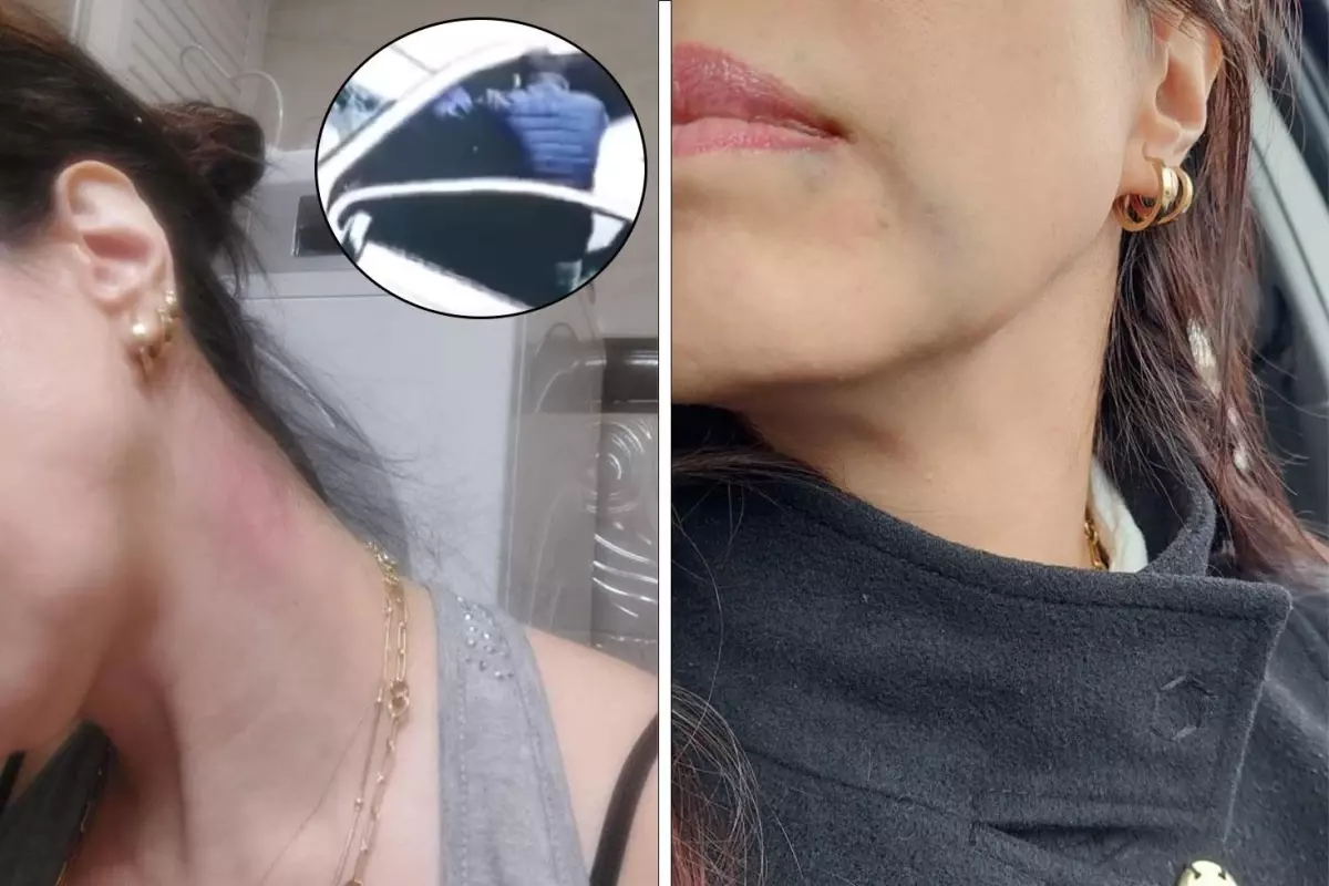 Astım hastası kadını öldüresiye dövdüler: "Beni öldü zannedip kaçtılar"