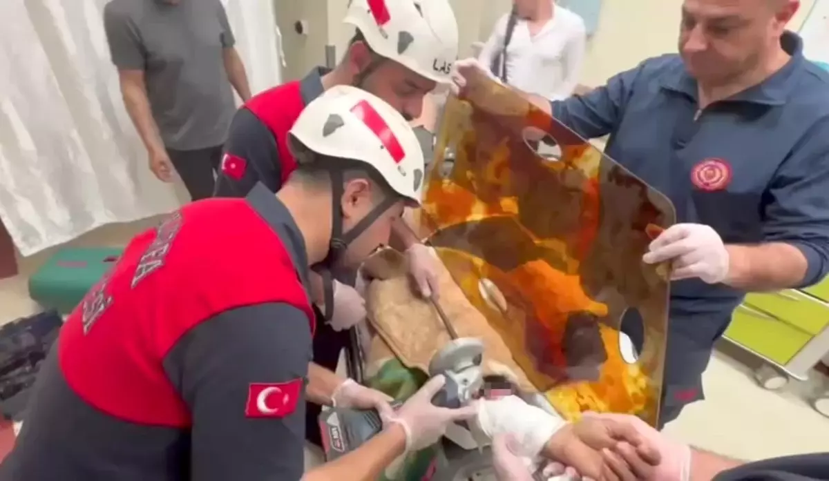 İşçinin Koluna Demir Şiş Saplandı