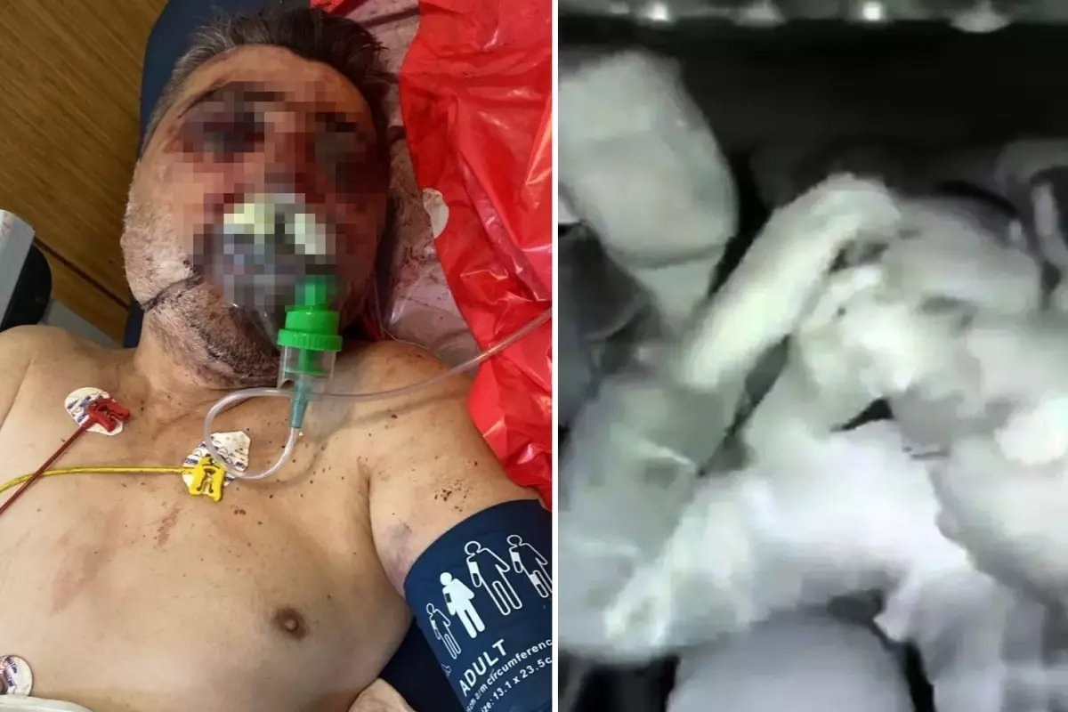 İngiliz boksör tarafından öldüresiye dövülen taksici dehşet anlarını anlattı