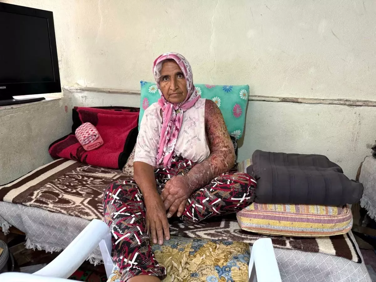 Adana\'da 4 Çocuk Annesinin Tedavi Umudu