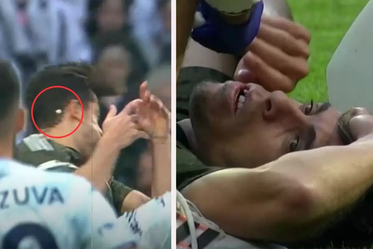 Beşiktaş\'ta üst üste şanssızlıklar! 2 sakatlık, bir de dişi kırılan futbolcu