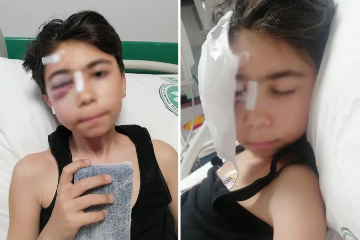 Oyun oynarken sabitlenmeyen kale direği başına düştü, çift görmeye başladı