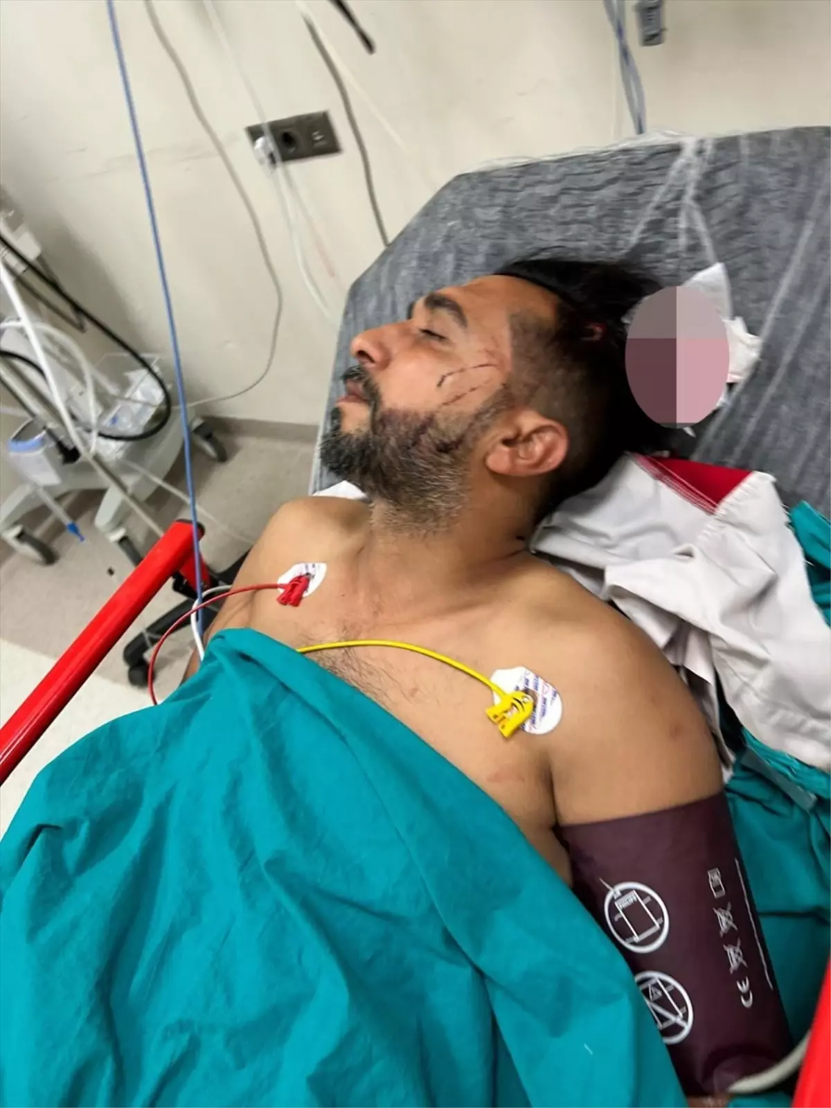 Döner Ustasına Yorgun Mermi Isabet Etti