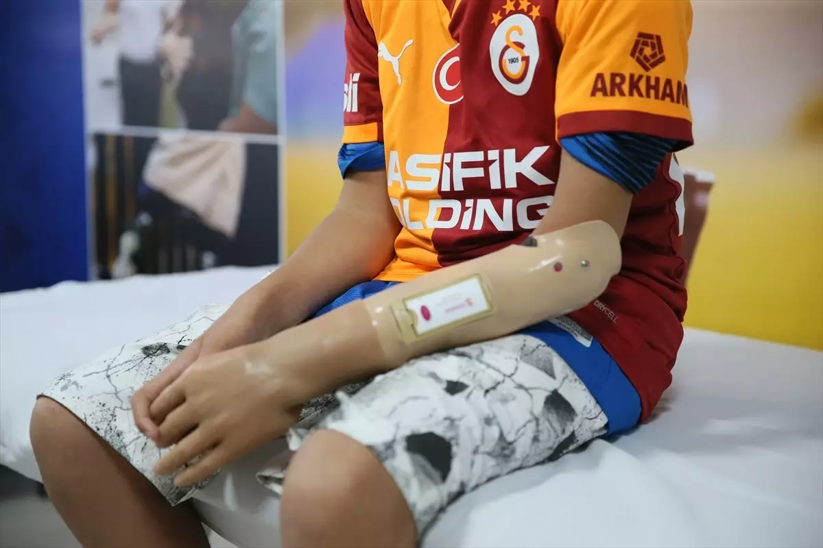 Mehmet Efe\'ye Protez Kol ve Oyun Keyfi