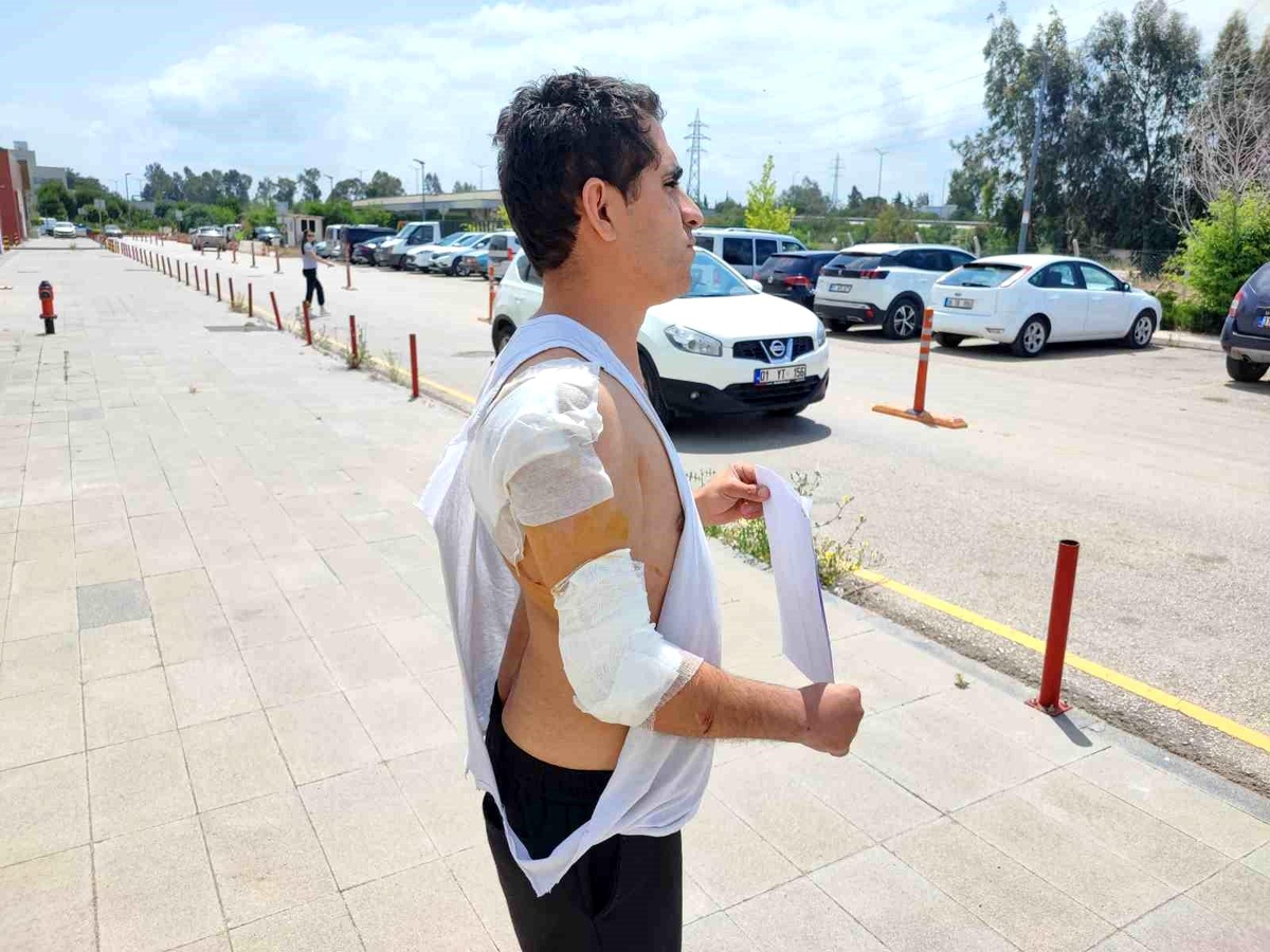 Adana\'da Kurt Köpeği Saldırısı