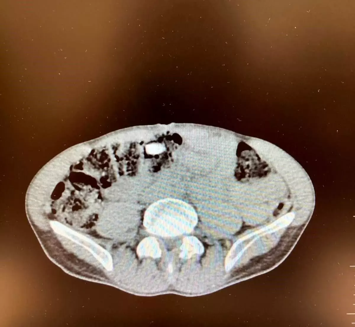 Denizli\'de Yabancı Uyruklu Uyuşturucu Taciri Tutuklandı