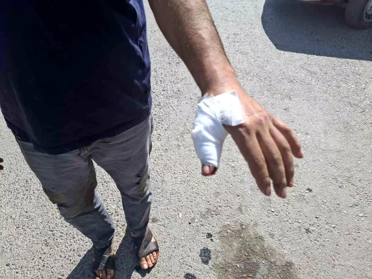 Kahramanmaraş\'ta Bayramda Acemi Kasaplar Hastaneye Koştu