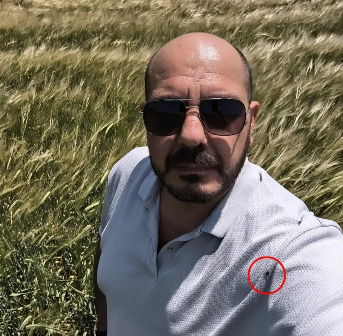 Selfi çekerken tişörtünde çok sayıda kene olduğunu fark etti