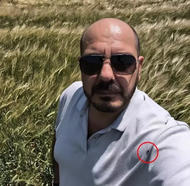 Genç Bir Adam Selfi Çekimi Sırasında Tişörtünde Kene İstilasıyla Karşılaştı