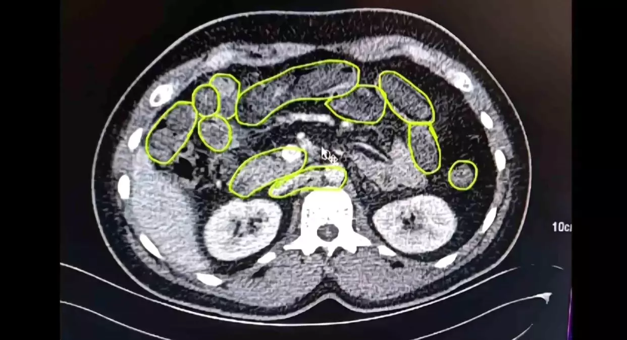Kayseri\'de Uyuşturucu Operasyonu