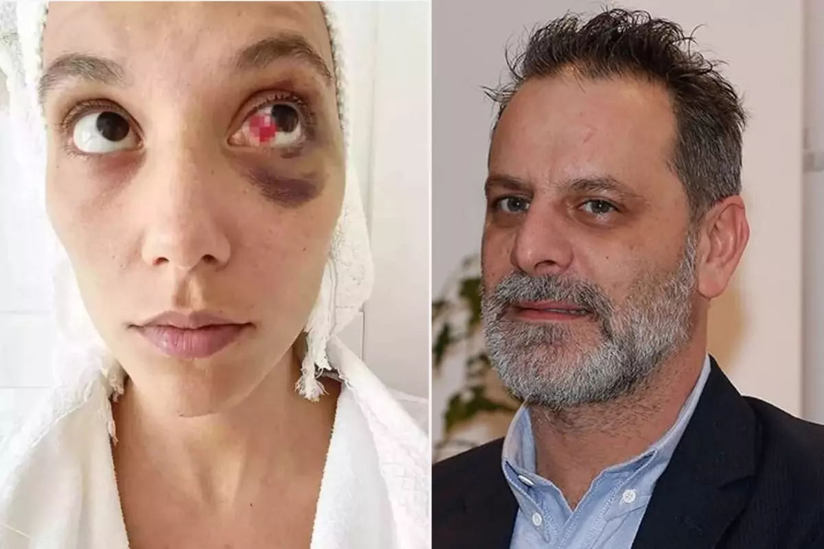 Ozan Güven\'e \'Kasten Yaralama\' Suçundan Hapis Cezası Verildi