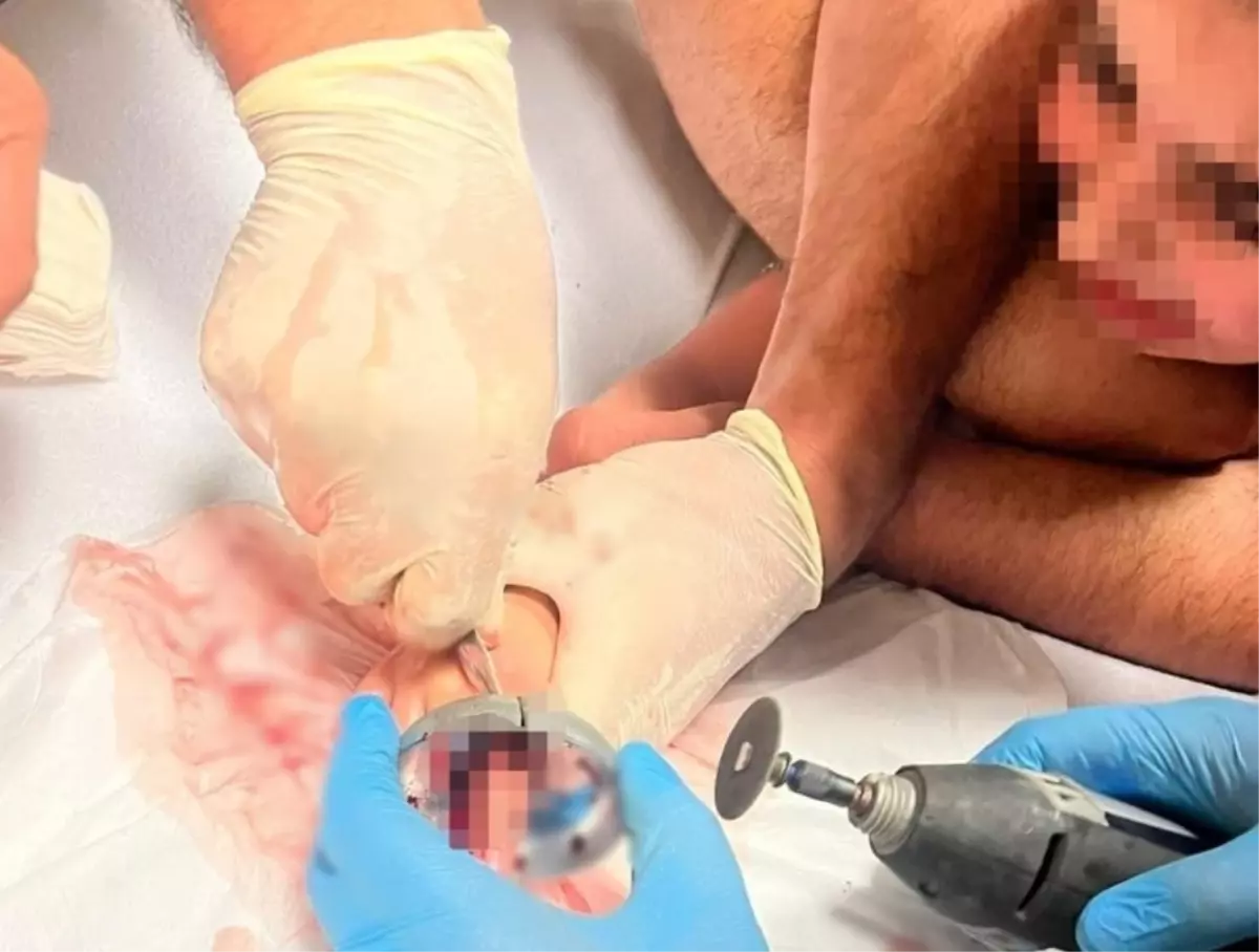 İnegöl\'de Çocuk Musluk Aynasına Sıkıştı