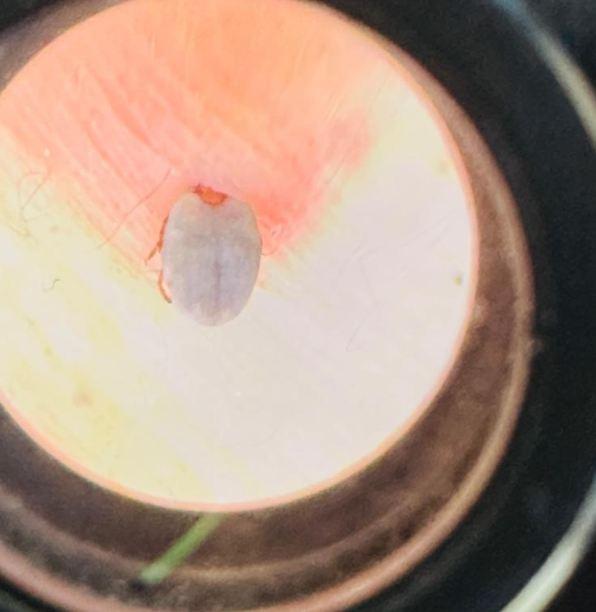 Halsizlik şikayetiyle hastaneye giden kadın hayatının şokunu yaşadı! Karnından çıkana inanamadı Halsizlik şikayetiyle hastaneye giden kadın hayatının şokunu yaşadı! Karnından çıkana inanamadı