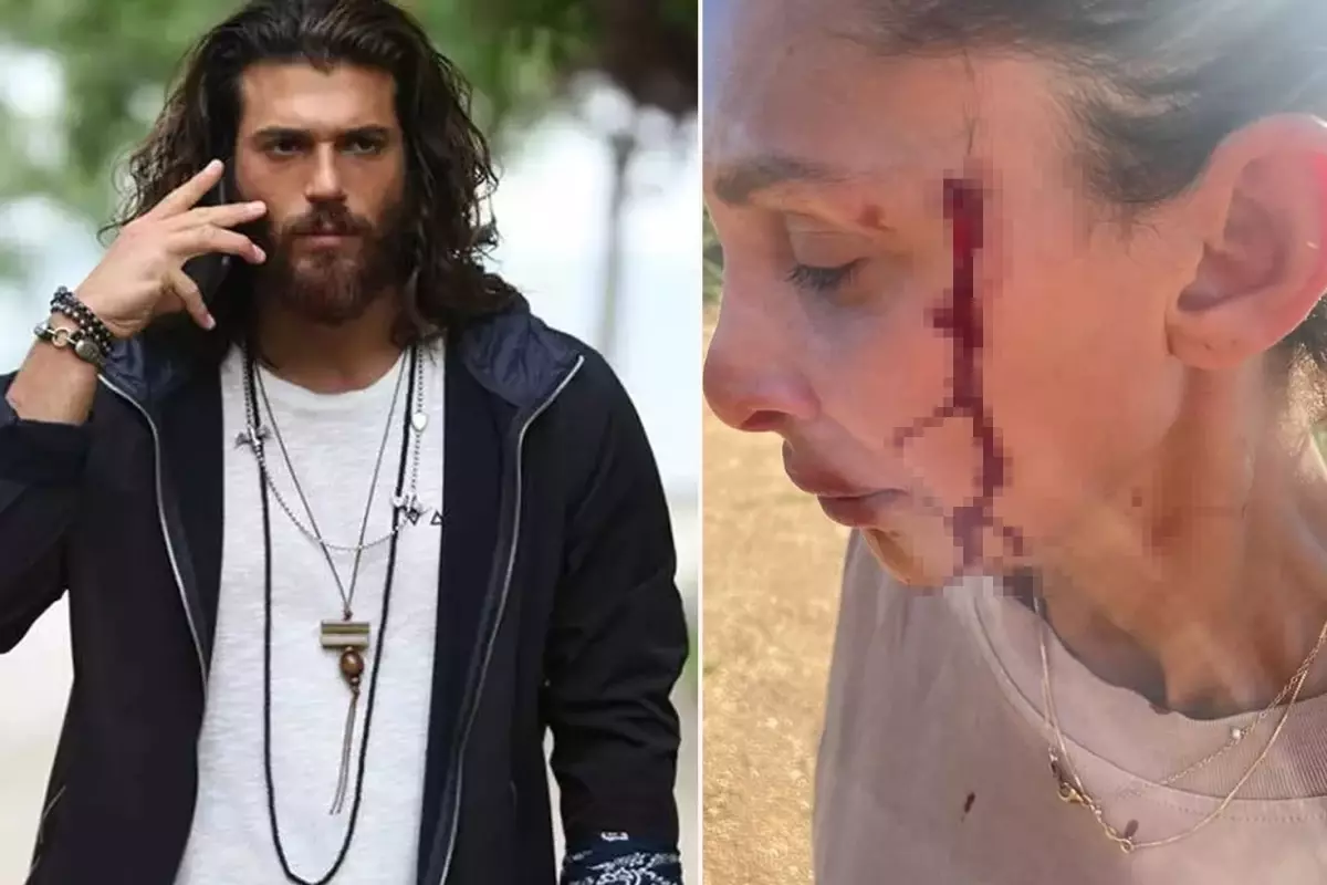 Can Yaman\'ın sevgilisi Sara Bluma şiddet gördüğünü açıkladı