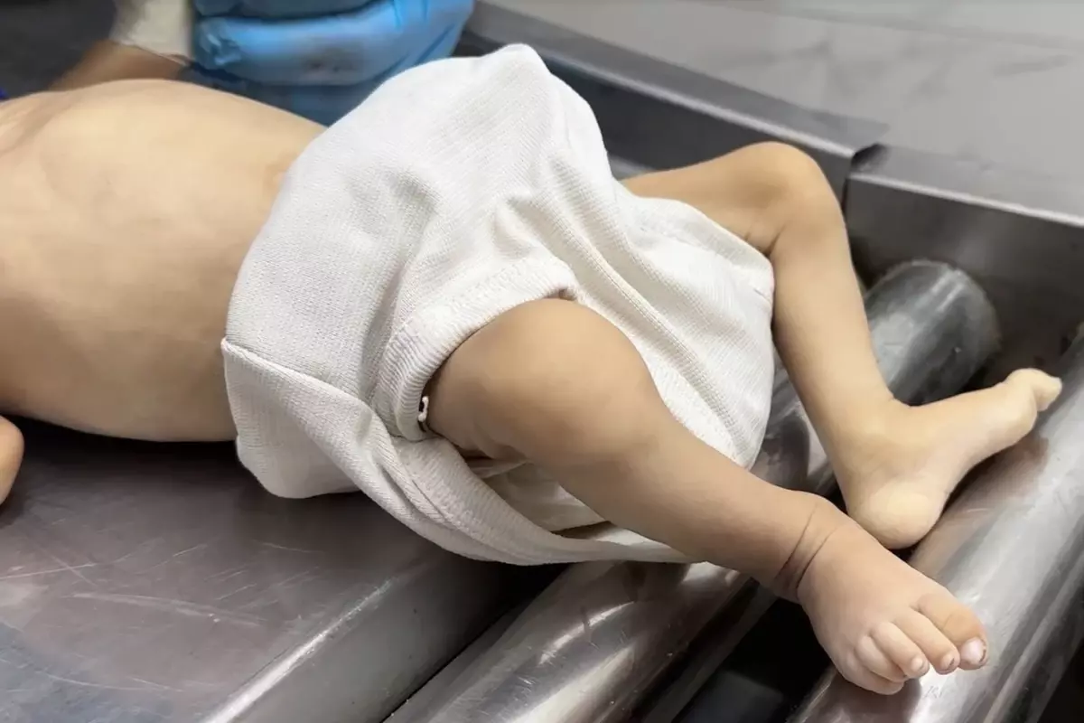 Açlıktan bebeğini kaybeden baba: Hepimiz öleceğiz