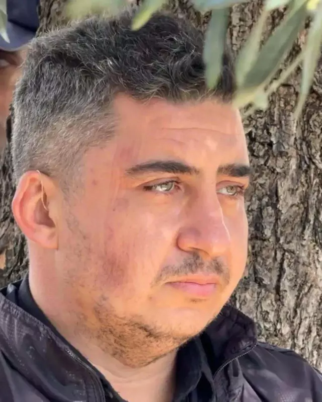 Aydın'da Yangın ve İddialar: Turgay Gezgin'in Kız Kardeşi Şüpheleri Sürdürüyor