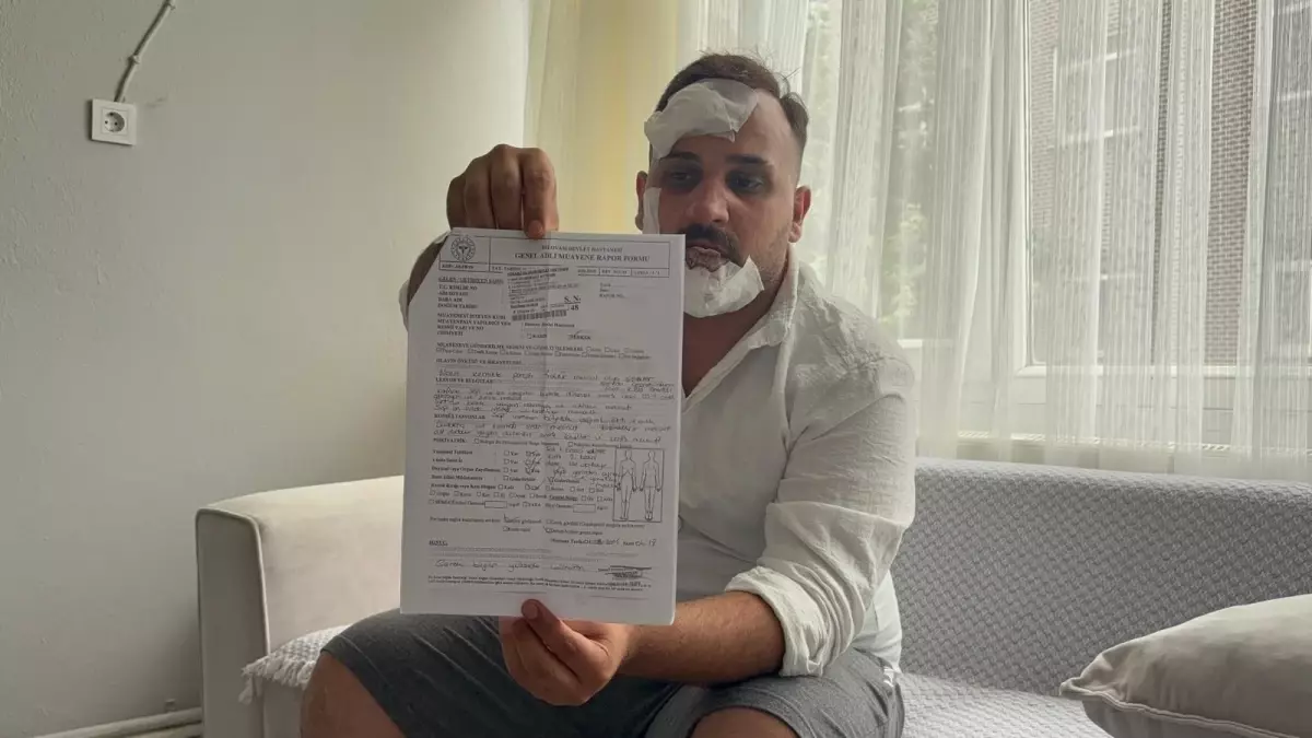 Polisler, Eski Sözlüsünden Ayrılan Şoförü Dövdü