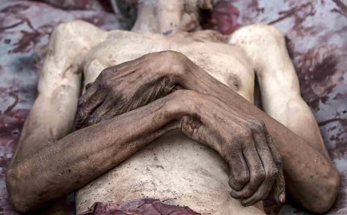 Gazze\'de Açlık Krizi: 6 Filistinli Hayatını Kaybetti