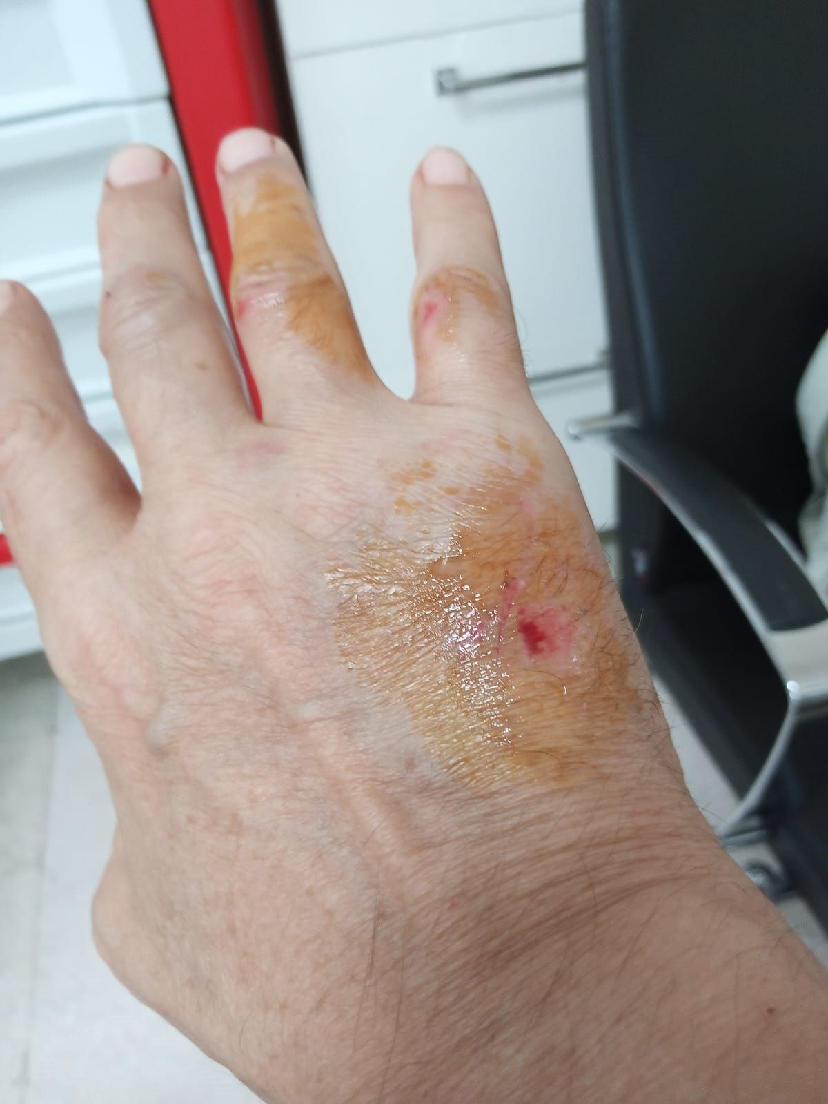Boşanma Aşamasındaki Adam Kayınbiraderinin Saldırısına Uğradı