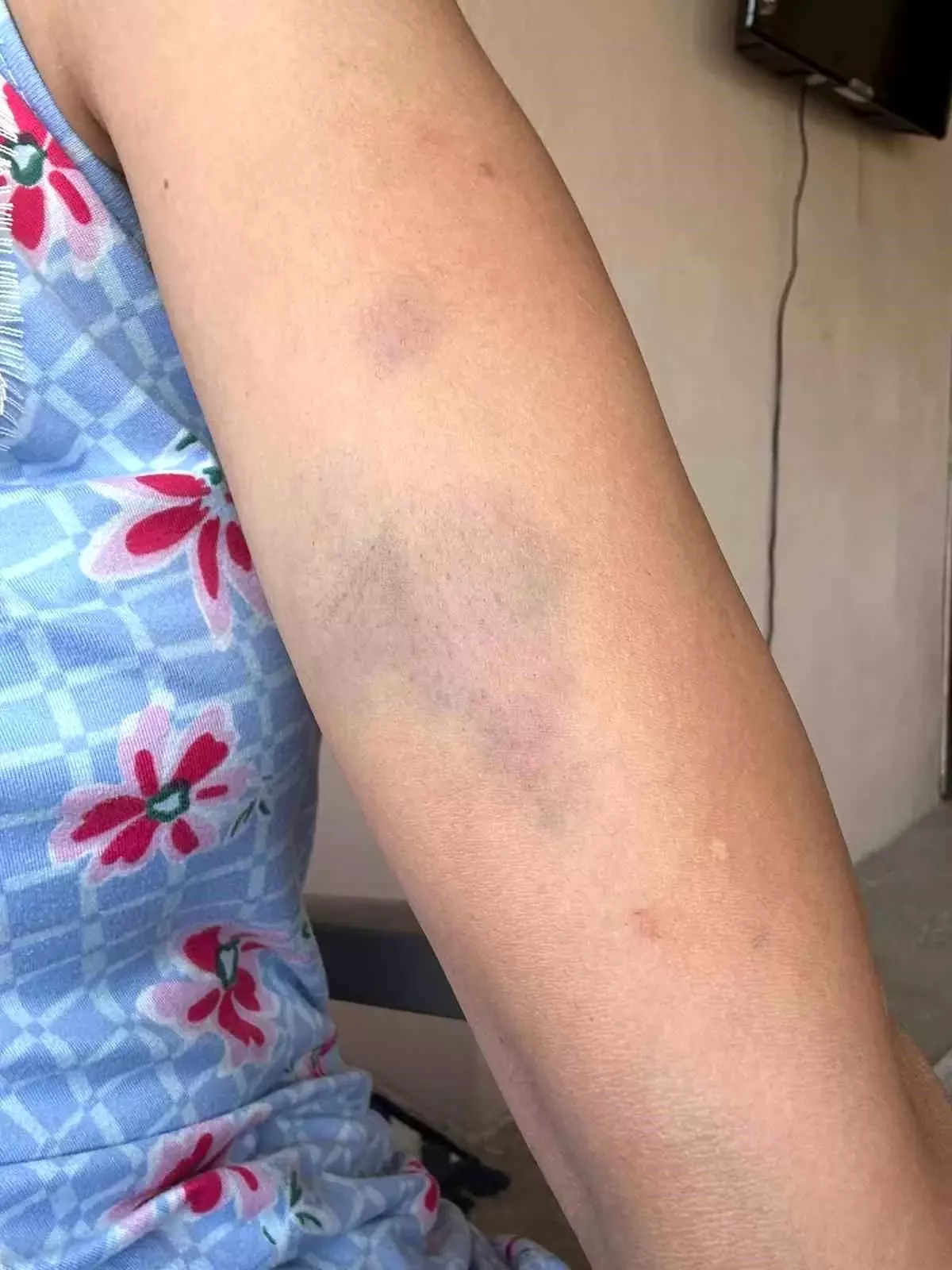 Veteriner ve Ailesi Sokak Köpeklerini Beslediği İçin Darp Edildi