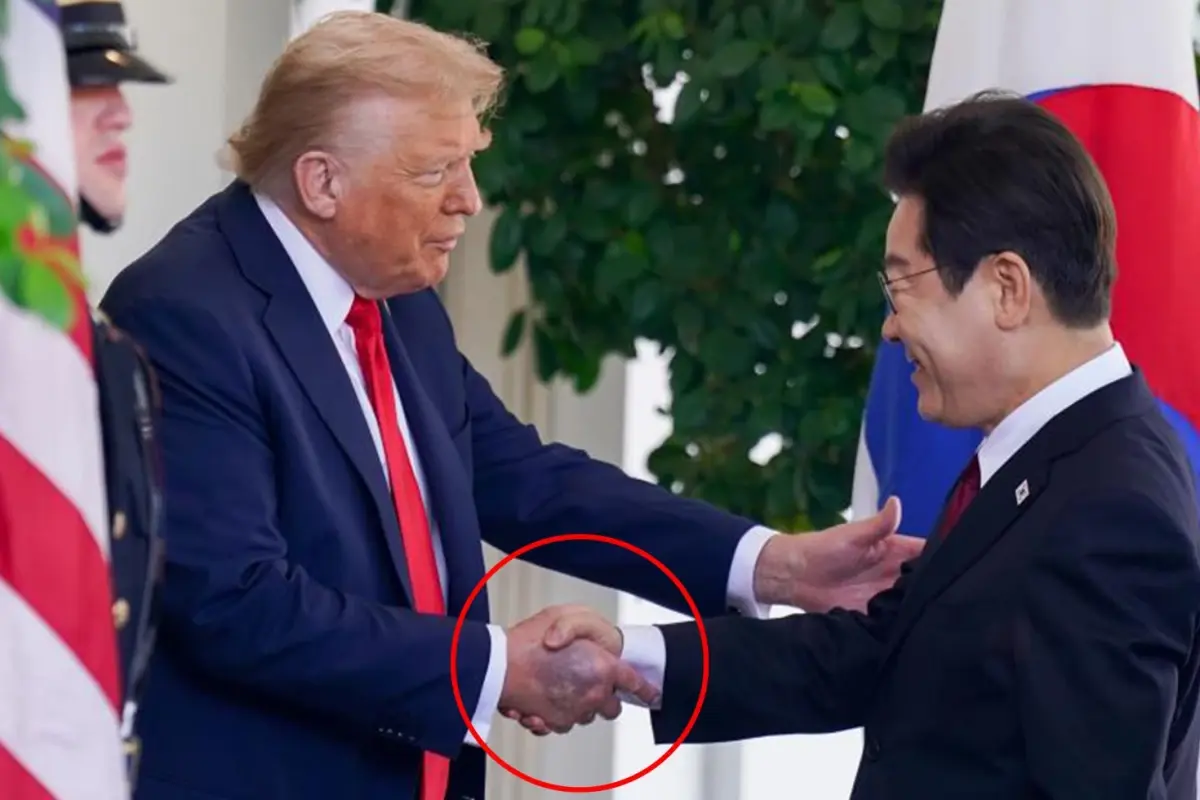 Trump\'ın elindeki morluk dikkat çekti, Beyaz Saray "Sık sık el sıkışmaktan" dedi