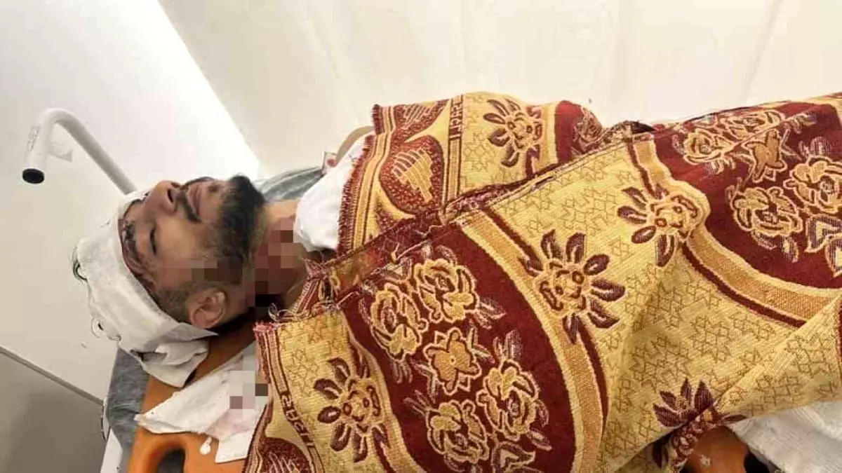 Arnavutköy\'de Taksiye Çarpan Kamyonet Sürücüsü Kaçtı