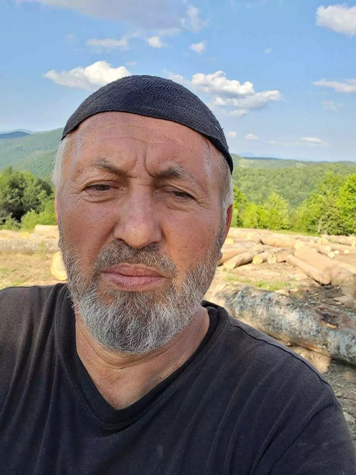 Ormanda Tomruk Düşen Adam Kalp Krizi Geçirdi