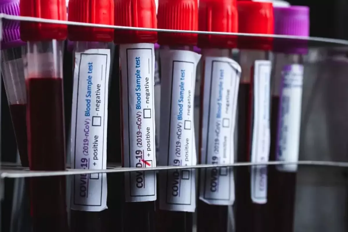 Acı eşiği en yüksek kan grubu belli oldu