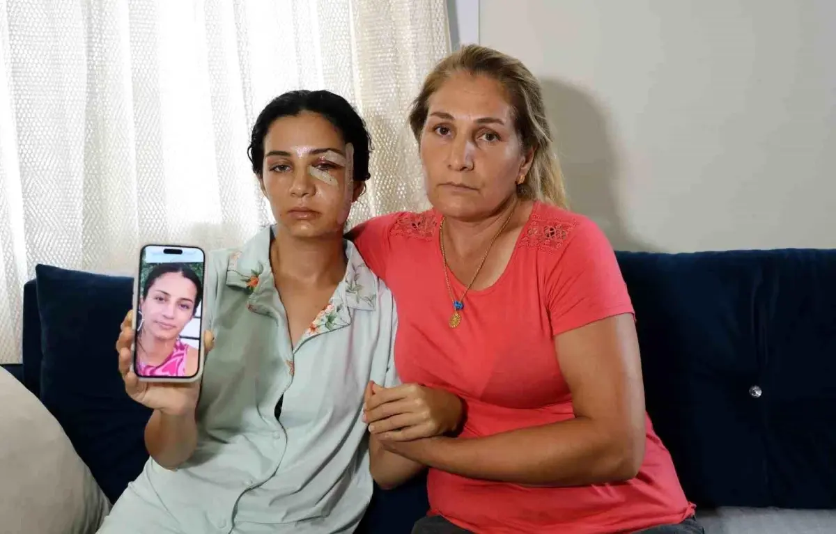 Eski eşinden şiddet gören kadın: Ben yaşarken kurtulayım, öldükten sonra değil