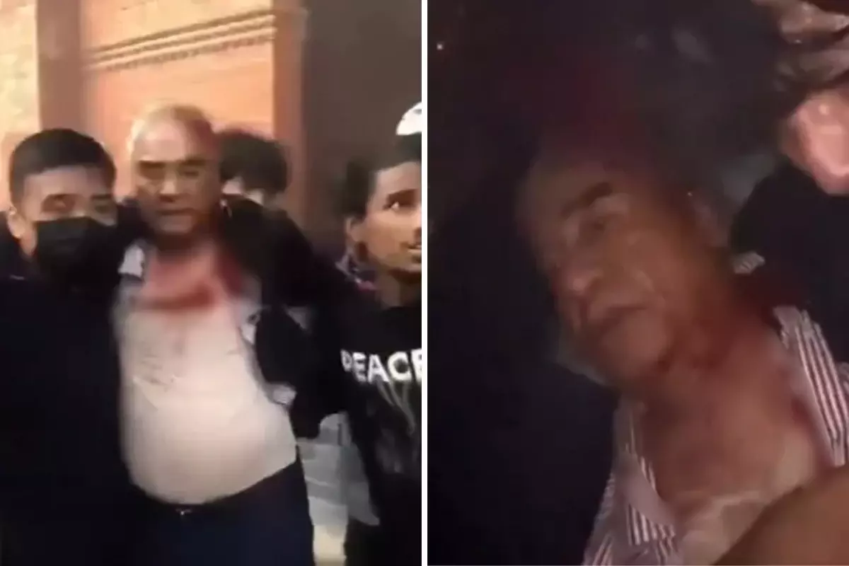 Nepal\'de Başbakan ve eşi, öfkeli kalabalık tarafından evlerinden çıkarılıp linç edildi