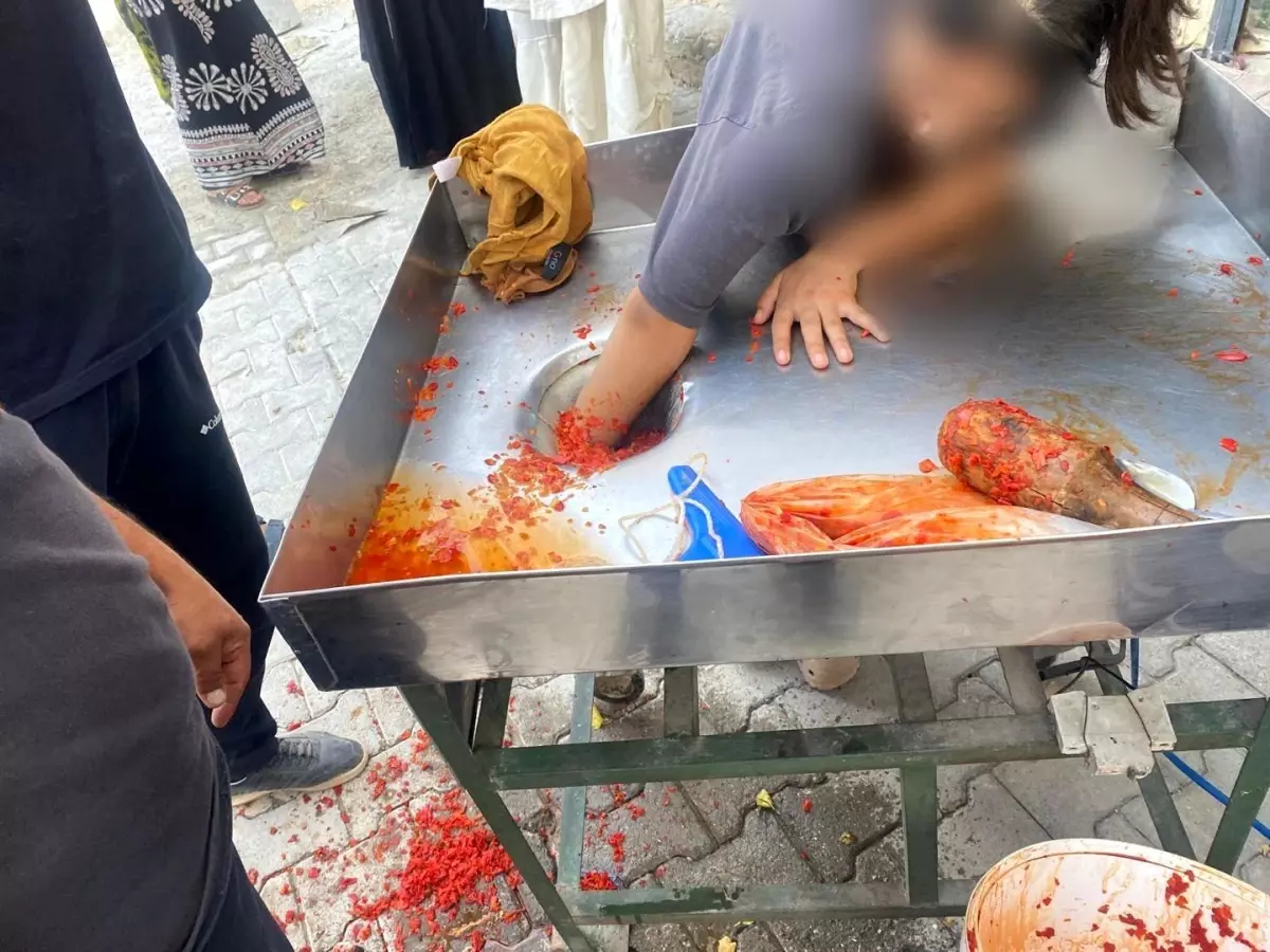 Şanlıurfa\'da Kız Çocuğu Salça Makinesine Eli Kaptırdı