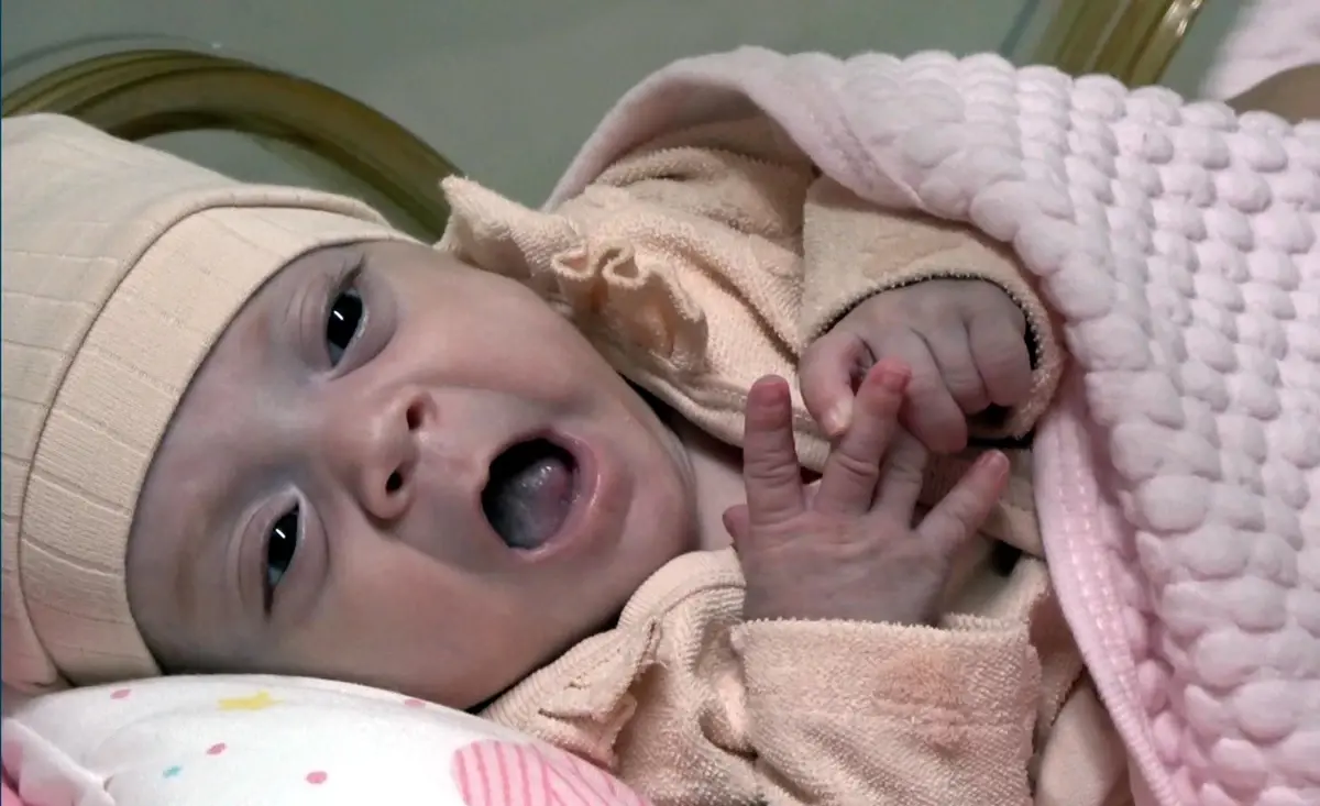 Elfin Maral Bebek Sağlığına Kavuştu