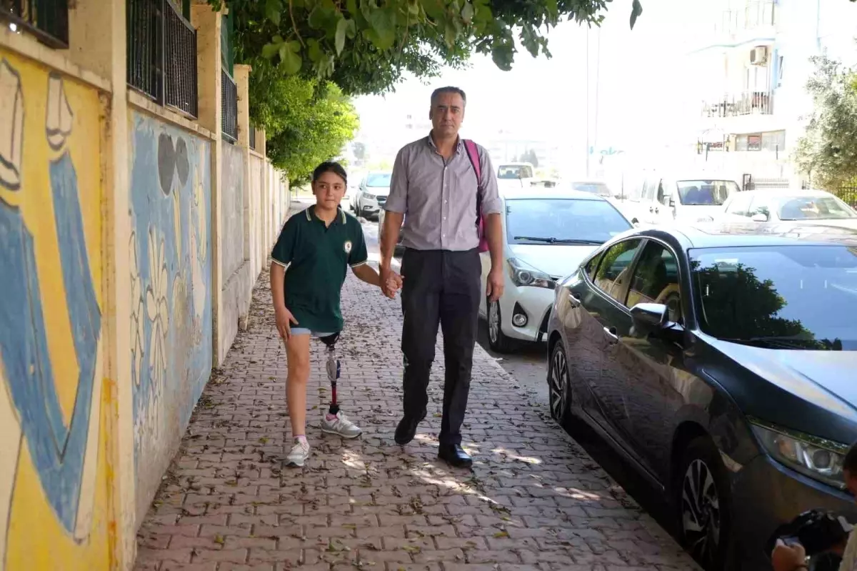 Özge, Yeni Protezine Kavuştu