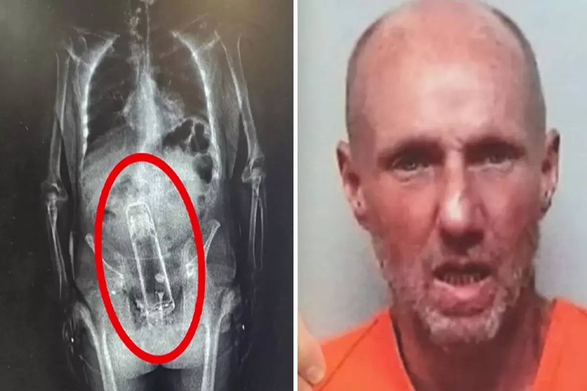 Hapishane girişinde fark edildi! X-Ray\'de ortaya çıkan gerçek polislerin ağzını açık bıraktı