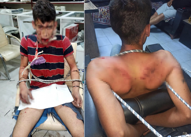 Kilitli depoda dişlerini kırıp hamam böceği yedirdiler! İşte istenen ceza