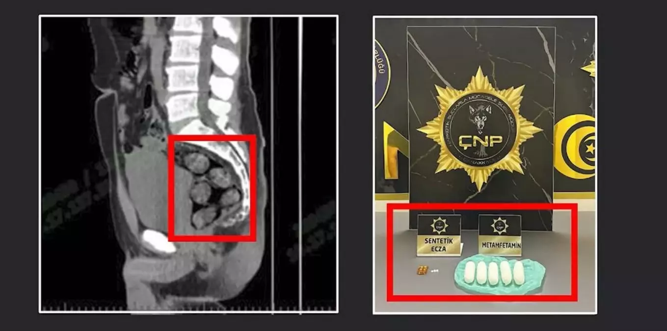 Çanakkale\'de Uyuşturucu Operasyonu
