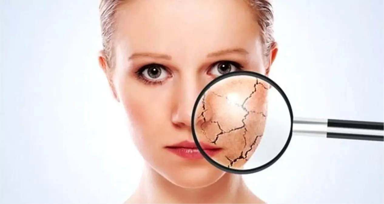 Kış Cilt Bakımı: Mezoterapi ile Yenileyin