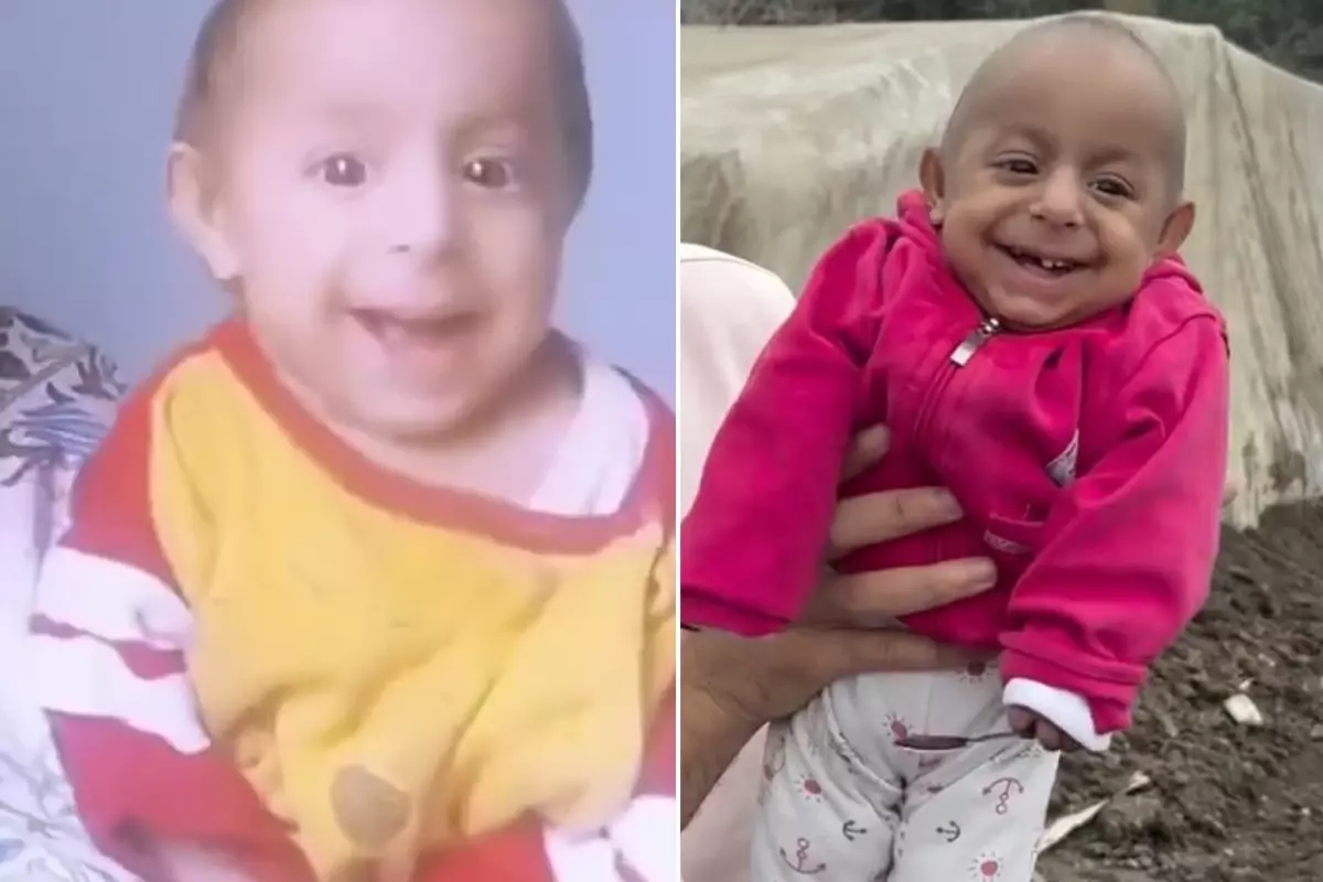 "Gülen Bebek" olarak tanınan Ökkeş Bebek hayatını kaybetti