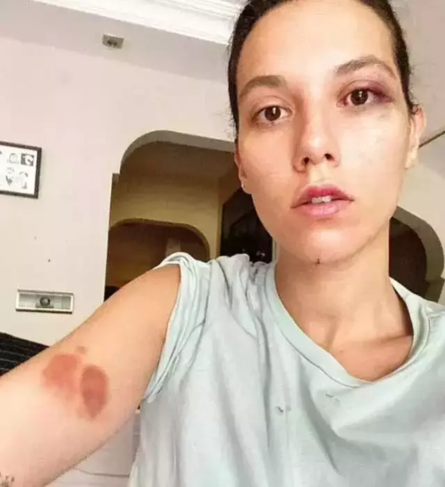 Ozan Güven'in hapis cezası kesinleşti Ozan Güven'in hapis cezası kesinleşti