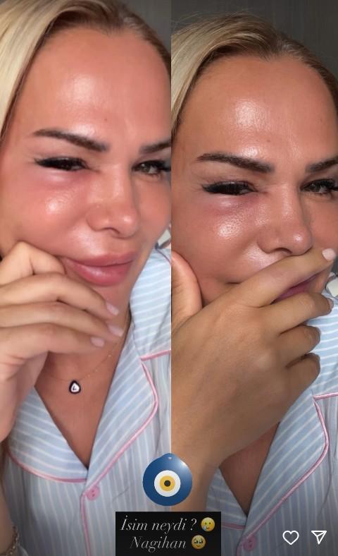 Survivor'ın yıldızı Nagihan Karadere'ye adeta nazar değdi: Şu halime bakın