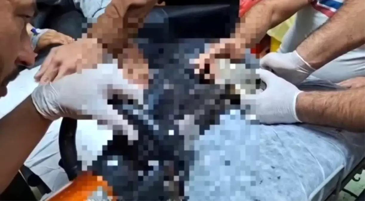 Kıyma Makinesine Kapanan Çocuk Kurtarıldı