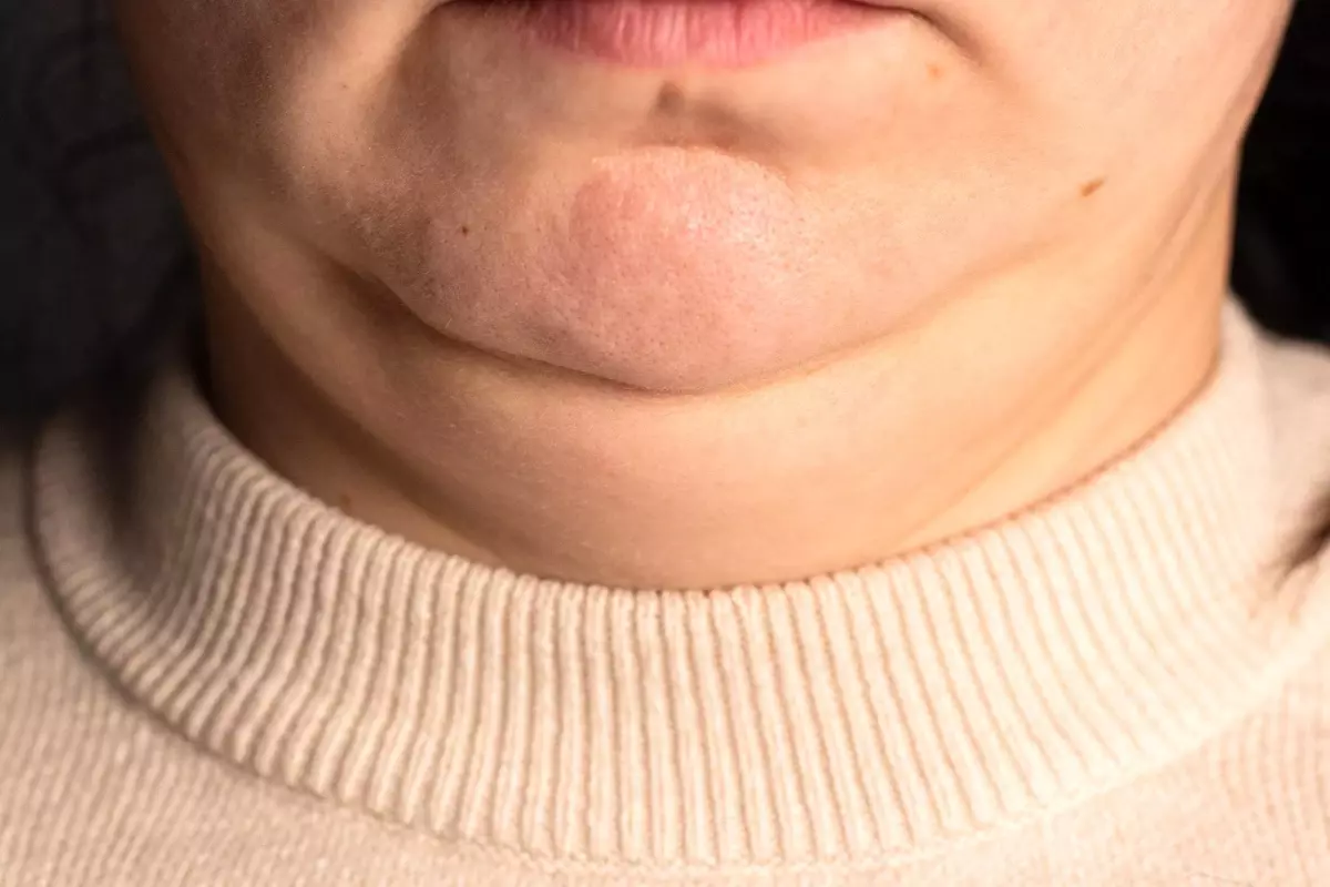 Boyun Kalınlığı Sağlığınızı Gösteriyor