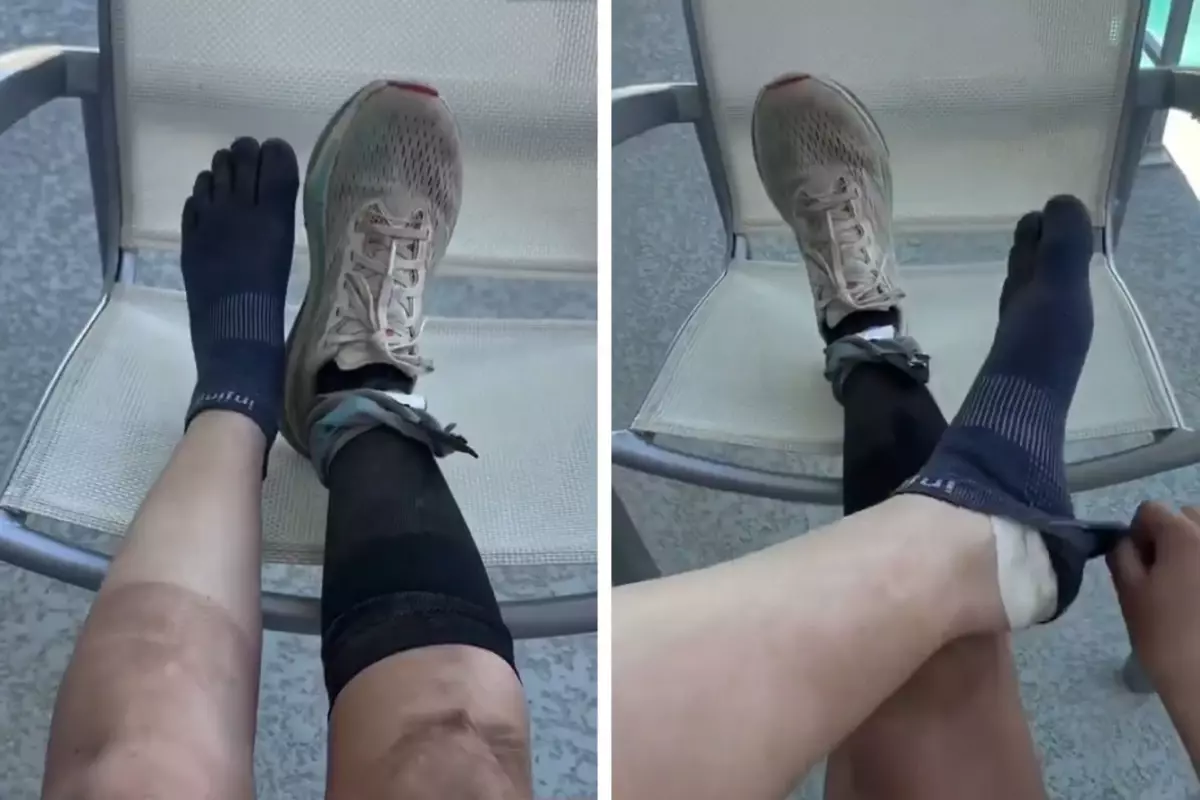 160 kilometre koşan sporcunun ayaklarının son hali inanılmaz