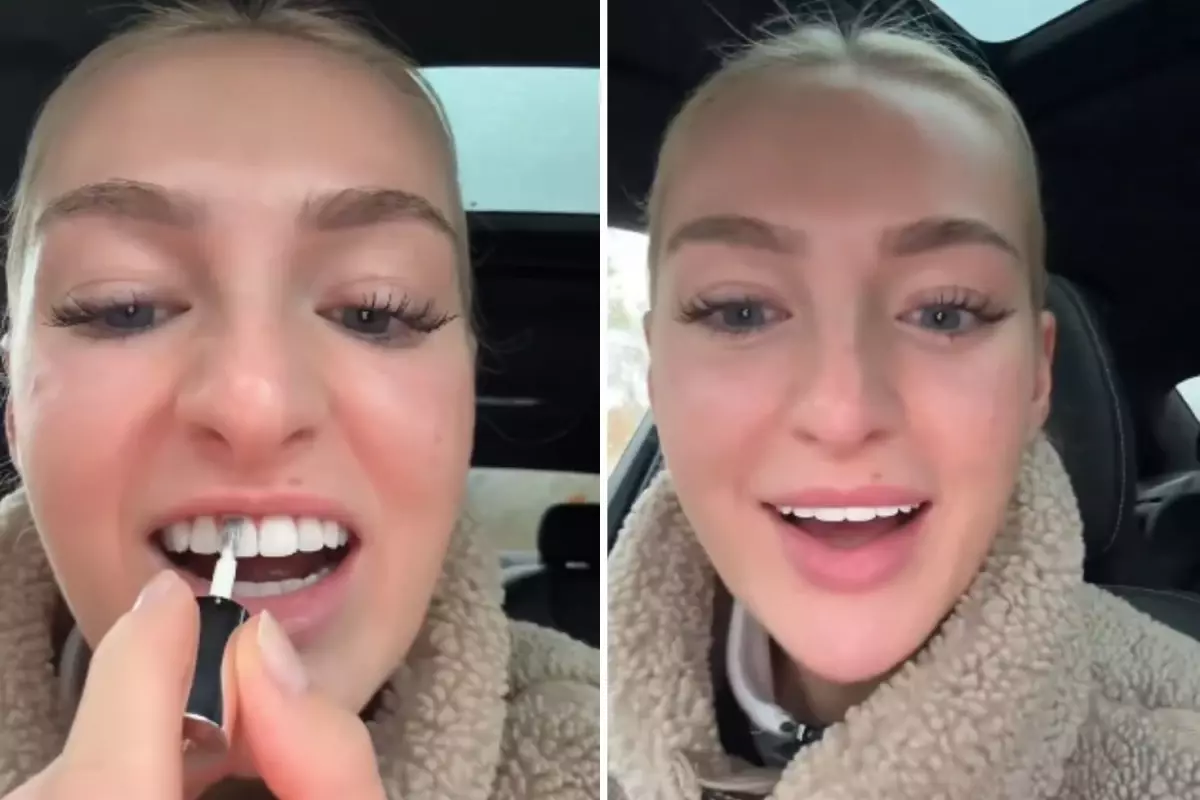 Dişlerini beyazlatmak için yaptığı akılalmaz!