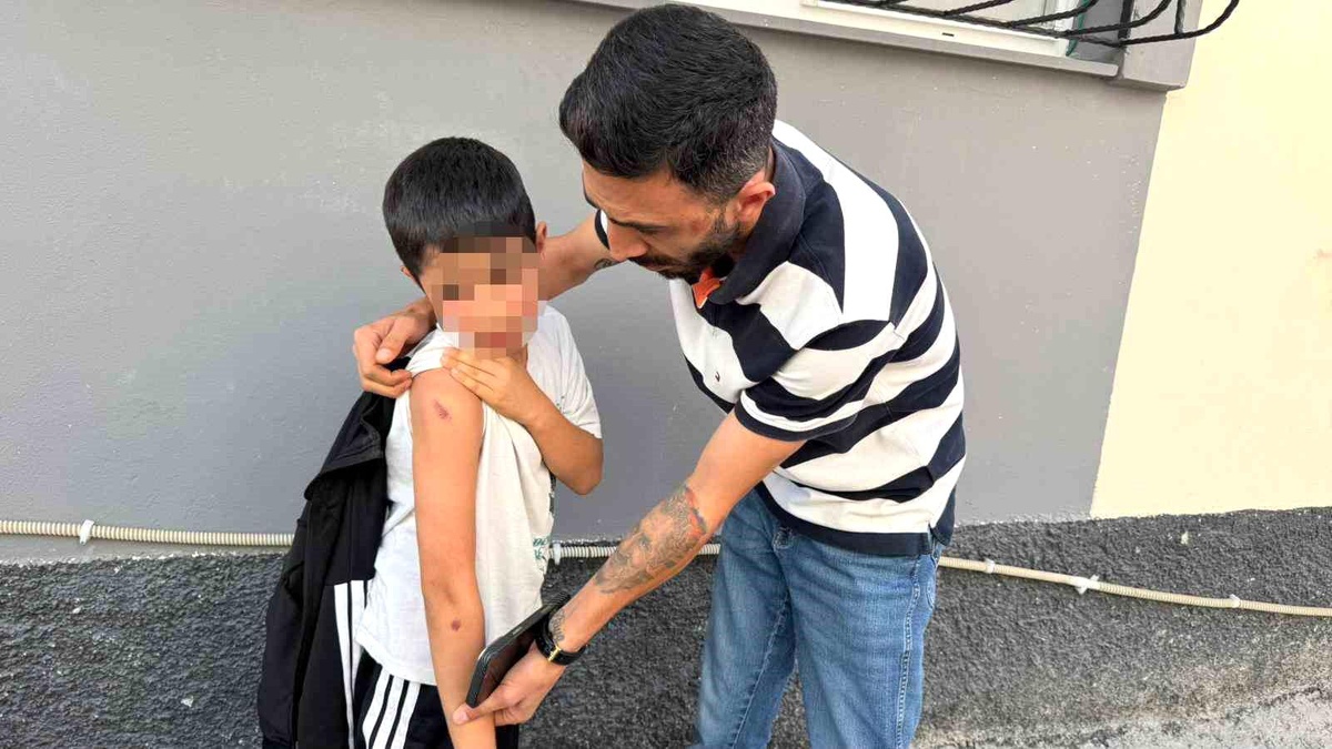 Adana\'da Çocuğa Şiddet: Şüpheli Tutuklandı