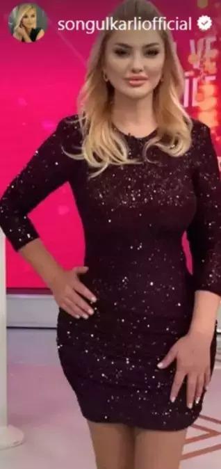 Estetik İddiaları bitmiyor! Songül Karlı'dan yanıt geldi Estetik İddiaları bitmiyor! Songül Karlı'dan yanıt geldi