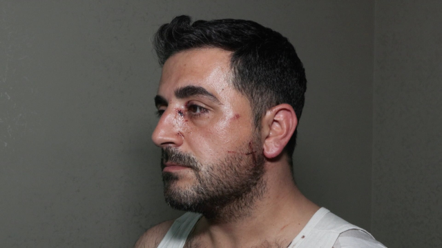 Esenyurt'ta eski kiracı ev sahibini bıçakla yaraladı^ Esenyurt'ta eski kiracı ev sahibini bıçakla yaraladı^