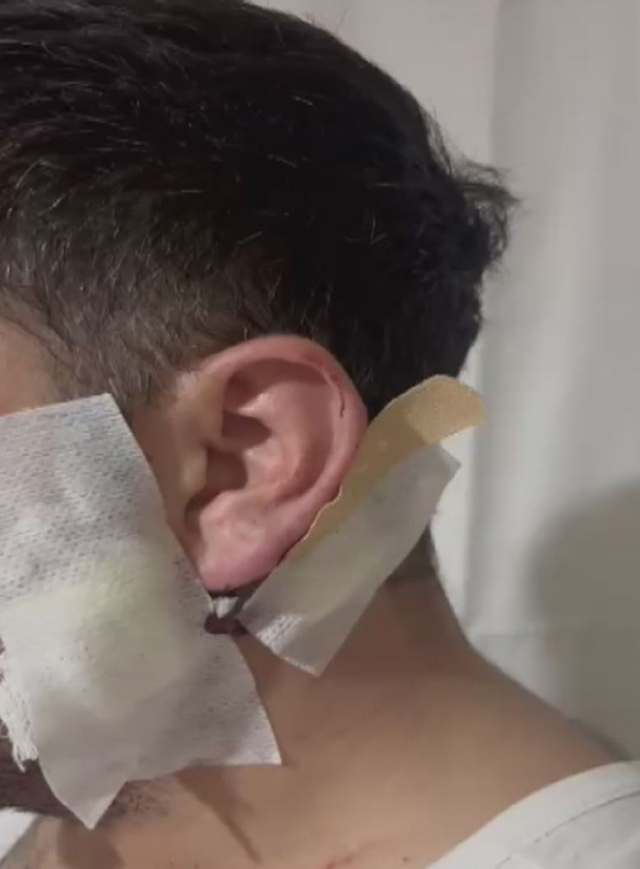 Esenyurt'ta eski kiracı ev sahibini bıçakla yaraladı^ Esenyurt'ta eski kiracı ev sahibini bıçakla yaraladı^