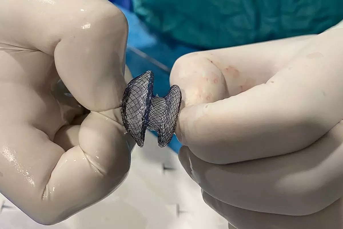 Kalpte Delik Tedavisinde Yeni Yöntemler