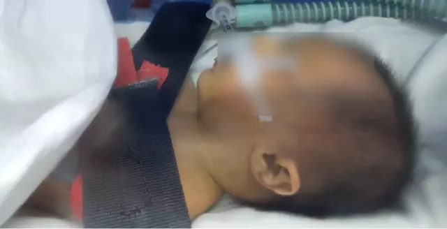 Özel hastanede skandal! Ahsen Bebek'in kafatasında kırık tespit edildi Özel hastanede skandal! Ahsen Bebek'in kafatasında kırık tespit edildi